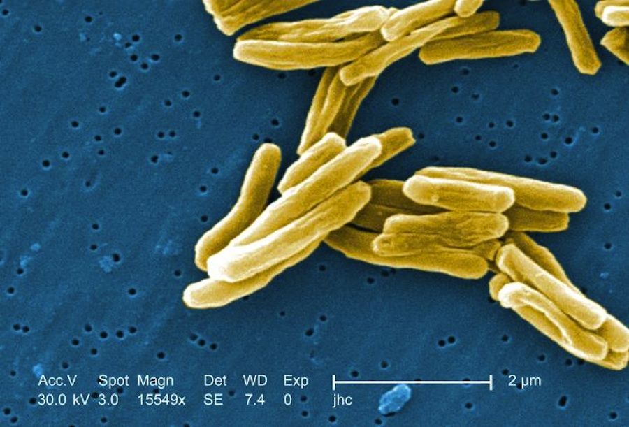 Colorized scanning electron microscope image of Mycobacterium tuberculosis bacteria. Numerous yellow, rod-shaped bacilli cluster together against a textured blue background. A scale bar at the bottom indicates a magnification of approximately 15,549× and a size reference of 2 micrometers.